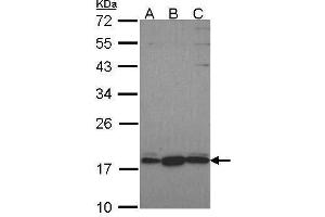 WB Image Sample (30 ug of whole cell lysate) A: Hela B: JurKat C: NT2D1 12% SDS PAGE GNRPX antibody antibody diluted at 1:1000 (GNRPX 抗体  (C-Term))