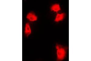 Immunofluorescent analysis of NF-kappaB p100 staining in HEK293T cells. (NFKB2 抗体  (C-Term))