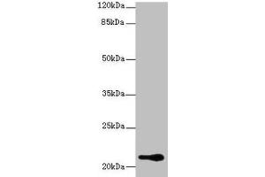 Western blot All lanes: RBBP9 antibody at 1 μg/mL + A375 whole cell lysate Secondary Goat polyclonal to rabbit IgG at 1/10000 dilution Predicted band size: 21, 20 kDa Observed band size: 21 kDa (RBBP9 抗体  (AA 1-186))