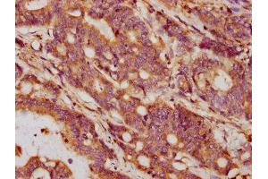 Immunohistochemistry (IHC) image for anti-Growth Differentiation Factor 5 (GDF5) (AA 202-501) antibody (ABIN7154549)