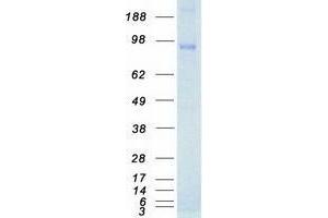 Validation with Western Blot