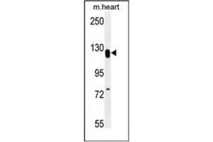 Western blot analysis of MED14 Antibody (Center) in mouse heart tissue lysates (35ug/lane). (MED14 抗体  (Middle Region))
