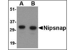Western blot analysis of NIPSNAP in human brain tissue lysate with this product at (A) 0. (NIPSNAP1 抗体  (Center))