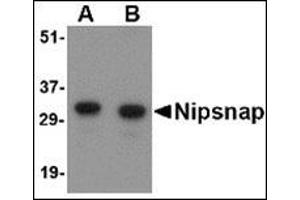 Western blot analysis of NIPSNAP in human brain tissue lysate with this product at (A) 0. (NIPSNAP1 抗体  (Center))