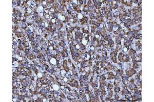 IHC analysis of BBS9 using anti-BBS9 antibody (ABIN7601518). (BBS9 抗体  (AA 37-793))