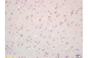Immunohistochemistry (Paraffin-embedded Sections) (IHC (p)) image for anti-Nuclear Receptor Subfamily 2, Group C, Member 2 (NR2C2) (AA 560-600) antibody (ABIN701185)