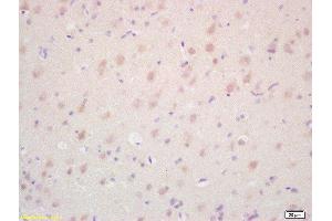 Formalin-fixed and paraffin embedded rat brain labeled with Rabbit Anti TAK1/MAP3K7 Polyclonal Antibody, Unconjugated  at 1:200 followed by conjugation to the secondary antibody and DAB staining (TR4 抗体  (AA 560-600))
