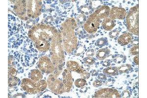 Image no. 1 for anti-tRNA Nucleotidyl Transferase, CCA-Adding, 1 (Trnt1) (AA 75-124) antibody (ABIN203116) (Trnt1 抗体  (AA 75-124))
