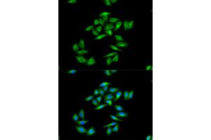 Immunofluorescence analysis of MCF-7 cells using CPT1A antibody.