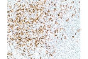 Immunohistochemistry (IHC) image for anti-CD8a Molecule (CD8A) (AA 22-180) antibody (ABIN7449371)