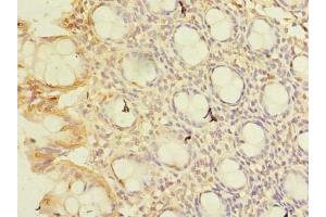 Immunohistochemistry of paraffin-embedded human colon tissue using ABIN7148768 at dilution of 1:100 (CWF19L1 抗体  (AA 101-330))