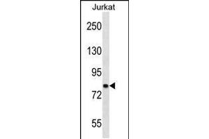 Western blot analysis in Jurkat cell line lysates (35ug/lane). (CACNB2 抗体  (AA 232-261))
