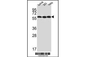 Western blot analysis of UTP6 Antibody in Jurkat,293,Hela cell line lysates (35ug/lane) (UTP6 抗体  (N-Term))