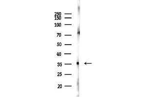 anti-LIM and Senescent Cell Antigen-Like Domains 2 (LIMS2) antibody