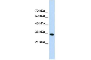 ADAMTS4 antibody used at 0. (ADAMTS4 抗体  (N-Term))