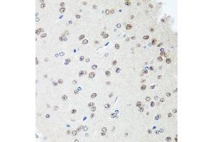 Immunohistochemistry of paraffin-embedded rat brain using SAP18 antibody at dilution of 1:100 (40x lens). (SAP18 抗体)