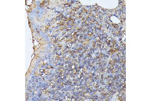 Immunohistochemistry of paraffin-embedded rat lung using STK24 antibody (ABIN6132364, ABIN6148602, ABIN6148603 and ABIN6214875) at dilution of 1:100 (40x lens). (STK24 抗体  (AA 312-431))