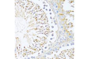 Immunohistochemistry of paraffin-embedded rat testis using DDX3Y antibody (ABIN6130260, ABIN6139496, ABIN6139497 and ABIN6215395) at dilution of 1:100 (40x lens). (DDX3Y 抗体  (AA 1-210))