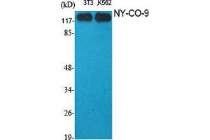 Western Blot (WB) analysis of specific cells using NY-CO-9 Polyclonal Antibody. (HDAC5 抗体  (C-Term))