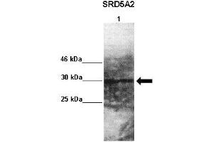 Lanes : Lane 1: 50ug monkey brain extract  Primary Antibody Dilution :  1:1000   Secondary Antibody : Goat anti rabbit-HRP  Secondary Antibody Dilution :  1:10,000  Gene Name : SRD5A2  Submitted by : Jonathan Bertin, Endoceutics Inc.