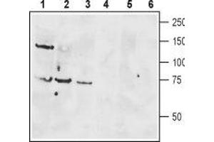 Western blot analysis of rat brain lysate (lanes 1 and 4), mouse brain membranes (lanes 2 and 5) and human Jurkat T cell leukemia cell lysate (lanes 3 and 6): - 1-3. (VIPR1 抗体  (Extracellular, N-Term))