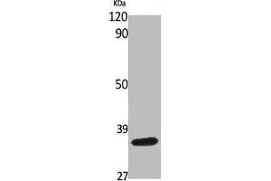 Western Blot analysis of various cells using BNIP-2 Polyclonal Antibody