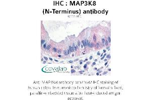 Image no. 1 for anti-Mitogen-Activated Protein Kinase Kinase Kinase 8 (MAP3K8) (N-Term) antibody (ABIN1736726) (MAP3K8 抗体  (N-Term))