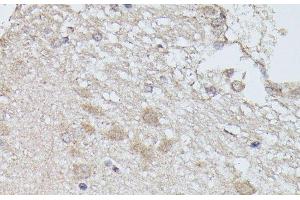 Immunohistochemistry of paraffin-embedded Rat brain using PPP2R5D Polyclonal Antibody at dilution of 1:100 (40x lens). (PPP2R5D 抗体)