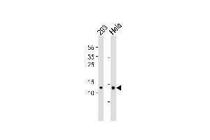 Western blot analysis of lysates from 293,Hela cell line (from left to right),using MRPL14 Antibody (ABIN6241786). (MRPL14 抗体)