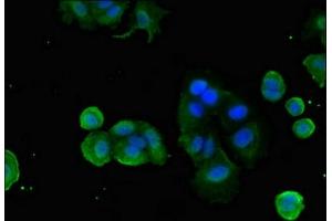 Immunofluorescent analysis of MCF-7 cells using ABIN7153175 at dilution of 1:100 and Alexa Fluor 488-congugated AffiniPure Goat Anti-Rabbit IgG(H+L) (FZD1 抗体  (AA 73-322))