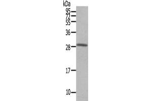 Gel: 12 % SDS-PAGE,Lysate: 40 μg,Primary antibody: ABIN7191746(OSM Antibody) at dilution 1/200 dilution,Secondary antibody: Goat anti rabbit IgG at 1/8000 dilution,Exposure time: 40 seconds (Oncostatin M 抗体)