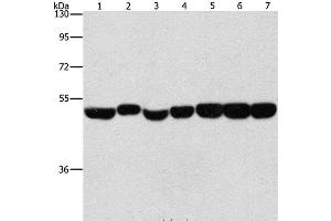 Western Blot analysis of Hela, A431 and hepG2 cell, Mouse brain and liver tissue, Mouse pancreas and Human fetal brain tissue using ENO1 Polyclonal Antibody at dilution of 1:700 (ENO1 抗体)