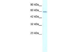 Human Jurkat; WB Suggested Anti-ZNF543 Antibody Titration: 0. (ZNF543 抗体  (Middle Region))