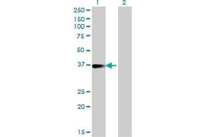 Western Blotting (WB) image for anti-Fc Fragment of IgE, Low Affinity II, Receptor For (CD23) (FCER2) (AA 1-321) antibody (ABIN515558)