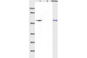 Lane 1: rat brain lysates Lane 2: rat kidney lysates probed with Anti CK4 Polyclonal Antibody, Unconjugated (ABIN730828) at 1:200 in 4 °C. (KRT4 抗体  (AA 256-360))