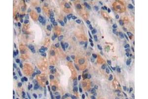 Used in DAB staining on fromalin fixed paraffin-embedded stomach tissue (TUBB1 抗体  (AA 166-451))