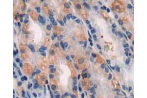 Used in DAB staining on fromalin fixed paraffin-embedded stomach tissue