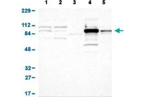 Western Blot analysis of (1) human cell line RT-4 (2) human cell line U-251MG sp (3) human plasma (IgG/HSA depleted) (4) human liver tissue, and (5) human tonsil tissue. (Glucose-6-Phosphate Dehydrogenase 抗体  (AA 43-154))