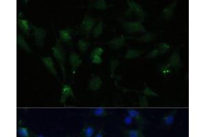 Immunofluorescence analysis of C6 cells using ZWINT Polyclonal Antibody at dilution of 1:100 (40x lens). (ZWINT 抗体)