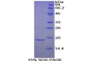 SDS-PAGE analysis of Dog Annexin A4 Protein. (Annexin IV 蛋白)
