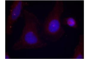 Image no. 3 for anti-PTK2B Protein tyrosine Kinase 2 beta (PTK2B) (pTyr402) antibody (ABIN196952) (PTK2B 抗体  (pTyr402))