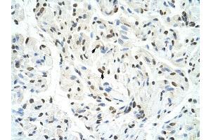 SFPQ antibody was used for immunohistochemistry at a concentration of 4-8 ug/ml to stain Skeletal muscle cells (arrows) in Human Muscle. (SFPQ 抗体)