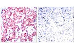 Image no. 1 for anti-GATA Binding Protein 1 (Globin Transcription Factor 1) (GATA1) (pSer142) antibody (ABIN196684) (GATA1 抗体  (pSer142))