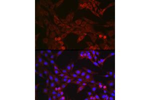 Immunofluorescence analysis of NIH/3T3 cells using GSDMD (Full Length+C terminal) Rabbit pAb (ABIN7267350) at dilution of 1:250 (40x lens). (GSDMD 抗体  (AA 276-484))