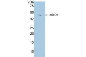 Detection of Recombinant C3c, Mouse using Polyclonal Antibody to Complement C3 Convertase (C3 Convertase) (Complement C3 Convertase 抗体)