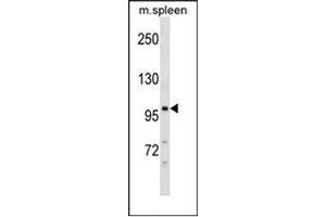 Western blot analysis of DSC3 Antibody (C-term) in mouse spleen tissue lysates (35ug/lane).