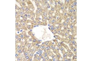 Immunohistochemistry (Paraffin-embedded Sections) (IHC (p)) image for anti-Aldehyde Dehydrogenase 2 Family (Mitochondrial) (ALDH2) (AA 1-380) antibody (ABIN3021779)