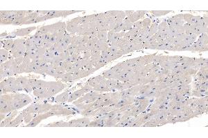 Detection of MYOC in Human Cardiac Muscle Tissue using Polyclonal Antibody to Myocilin (MYOC) (MYOC 抗体  (AA 224-471))