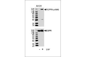 Western blot analysis of lysates from A431 cell line, untreated or treated with EGF, 100 ng/mL, using EGFRY Antibody (p1069) (ABIN1881283 and ABIN2839662) (upper) or EGFR (lower).