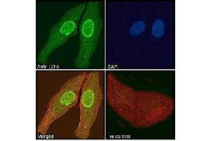 ABIN570707 Immunofluorescence analysis of paraformaldehyde fixed U2OS cells, permeabilized with 0. (E2F8 抗体  (Internal Region))
